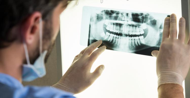 Dentist looking at a dental x-ray