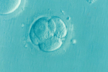 IVF fertility service cuts Healthwatch concern